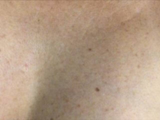 방송 스크린 샷 Alianakiss