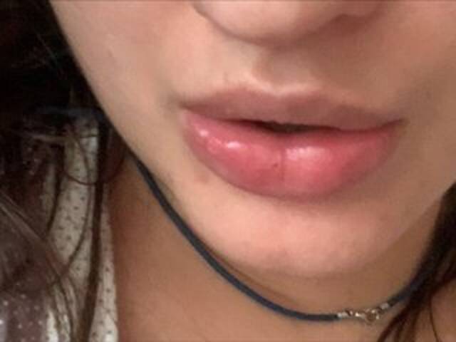 방송 스크린 샷 Rinaru555555